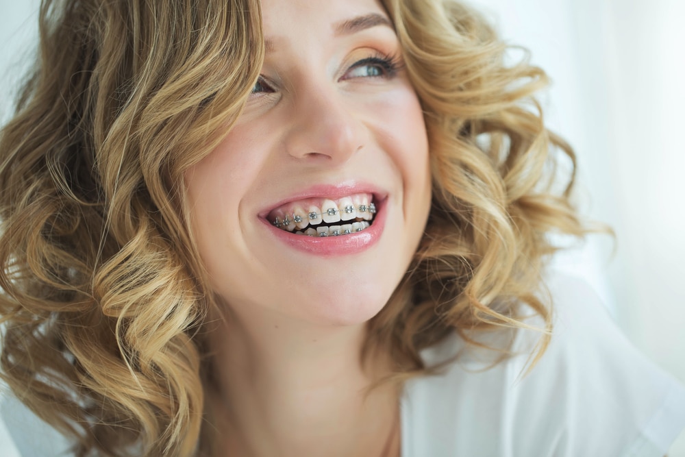 Orthodontist in Rotherham - Close-up photo of a woman smiling. She is wearing braces. Her hair is shoulder length, blond and curly. She is looking over her left shoulder.